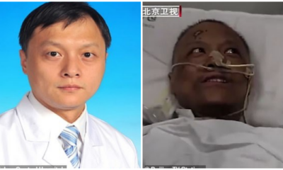 เผยภาพ 2 แพทย์จีนผิวเปลี่ยนคล้ำหนัก หลังตับเสียหายหนักเพราะติดโควิด - World Of Buzz