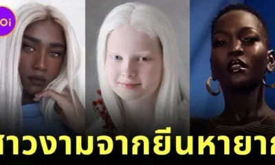 เผย 5 ผู้หญิงสวยจากพันธุกรรมที่หายากที่สุดในโลก