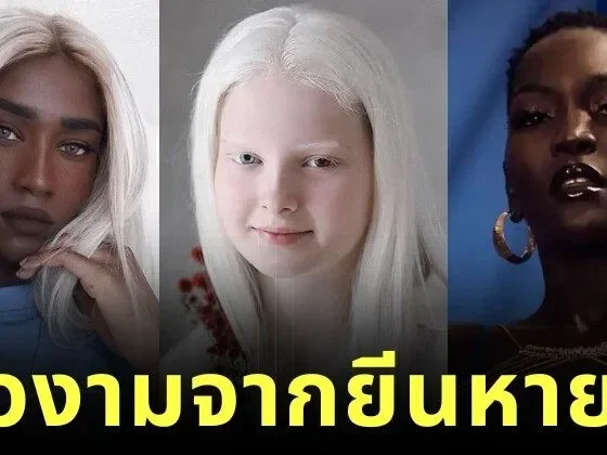 เผย 5 ผู้หญิงสวยจากพันธุกรรมที่หายากที่สุดในโลก