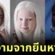 เผย 5 ผู้หญิงสวยจากพันธุกรรมที่หายากที่สุดในโลก