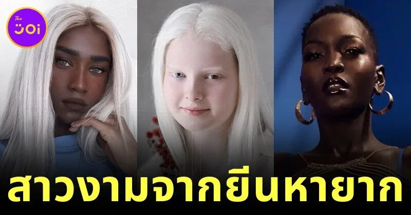 เผย 5 ผู้หญิงสวยจากพันธุกรรมที่หายากที่สุดในโลก