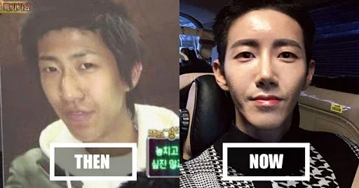 เผย 7 ไอดอล K-POP ที่ยืดอกยอมรับว่าทำศัลยกรรมในปี 2025