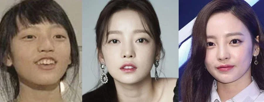เผย 7 ไอดอล K-POP ที่ยืดอกยอมรับว่าทำศัลยกรรมในปี 2025