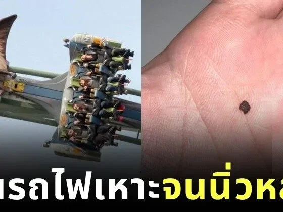 ชายจีนเล่นรถไฟเหาะ 3 รอบ… จนนิ่วในไตหลุด?! หมอย้ำ "อย่าเลียนแบบ" แม้ผลลัพธ์จะน่าทึ่งก็ตาม