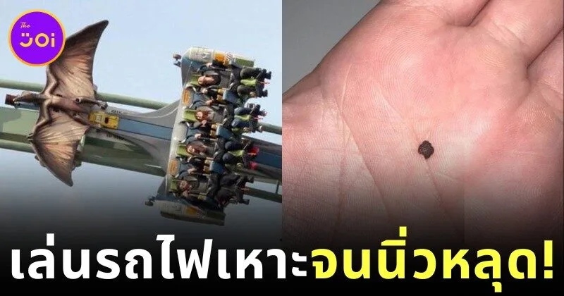 ชายจีนเล่นรถไฟเหาะ 3 รอบ… จนนิ่วในไตหลุด?! หมอย้ำ "อย่าเลียนแบบ" แม้ผลลัพธ์จะน่าทึ่งก็ตาม