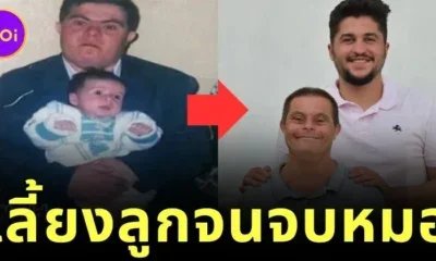 พ่อผู้ป่วยดาวน์ซินโดรมเลี้ยงดูลูกชายจนจบแพทย์ พิสูจน์ความรักสร้างปาฏิหาริย์ได้จริง