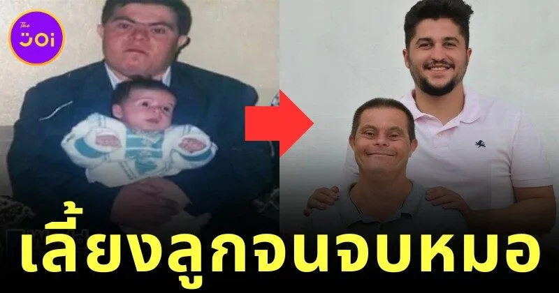 พ่อผู้ป่วยดาวน์ซินโดรมเลี้ยงดูลูกชายจนจบแพทย์ พิสูจน์ความรักสร้างปาฏิหาริย์ได้จริง