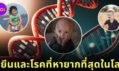 รู้จัก 5 ยีนมนุษย์ที่หายากที่สุดในโลก ความลับของพันธุกรรมที่แทบไม่มีใครเป็น