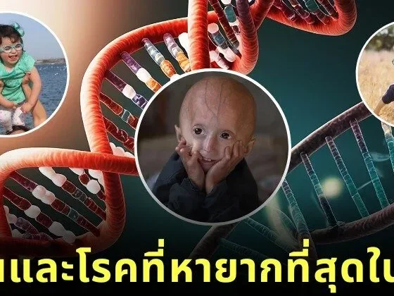 รู้จัก 5 ยีนมนุษย์ที่หายากที่สุดในโลก ความลับของพันธุกรรมที่แทบไม่มีใครเป็น