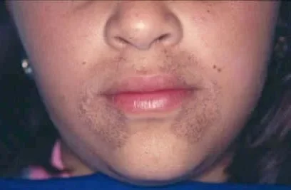 รู้จัก 5 ยีนมนุษย์ที่หายากที่สุดในโลก ความลับของพันธุกรรมที่แทบไม่มีใครเป็น