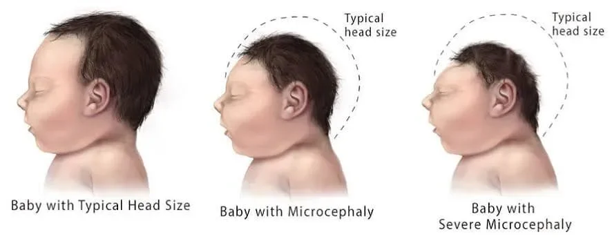 รู้จัก 5 ยีนมนุษย์ที่หายากที่สุดในโลก ความลับของพันธุกรรมที่แทบไม่มีใครเป็น